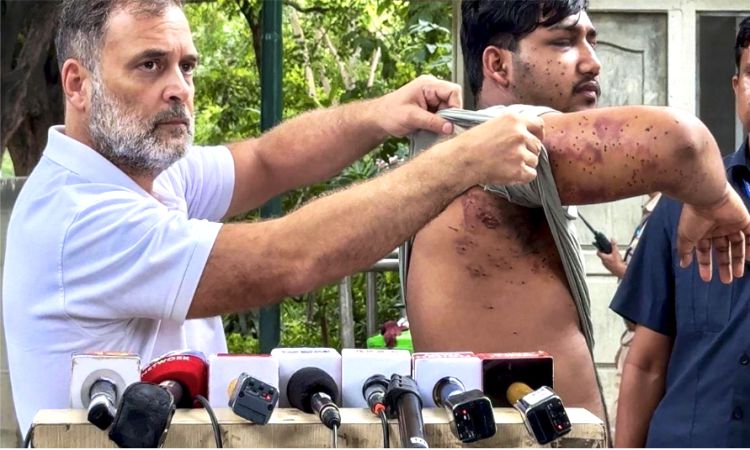 راہول گاندھی کا کہنا ہے کہ مرکز مظاہرین کے خلاف پیلٹ گن کے استعمال پر جھوٹ بول رہا ہے۔
